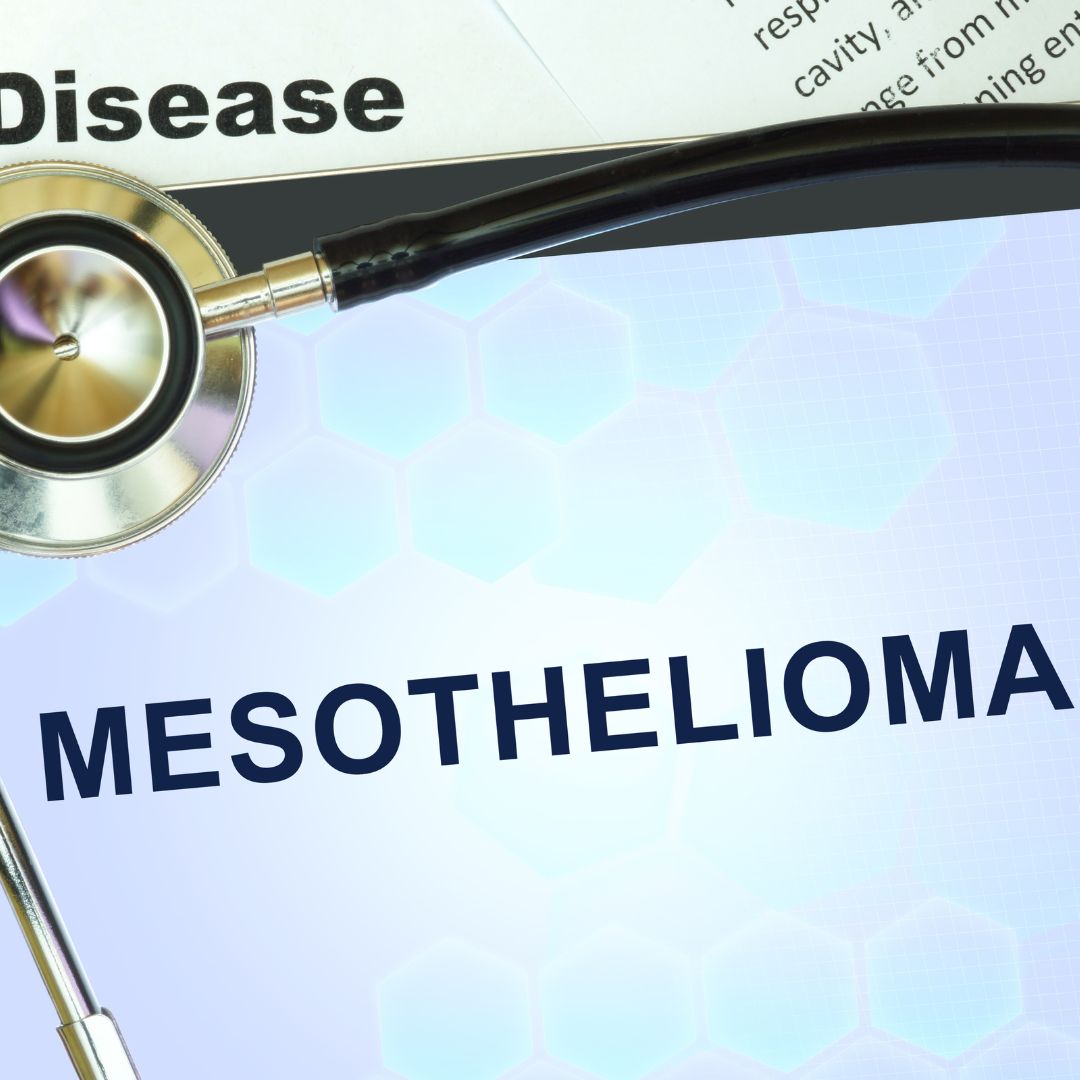 Mesothelioma Patients Find Treatment From Skin Cancer Cream